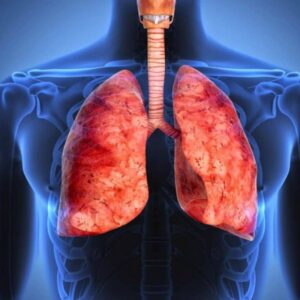 Cáncer pulmonar