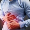 Cáncer de Estómago